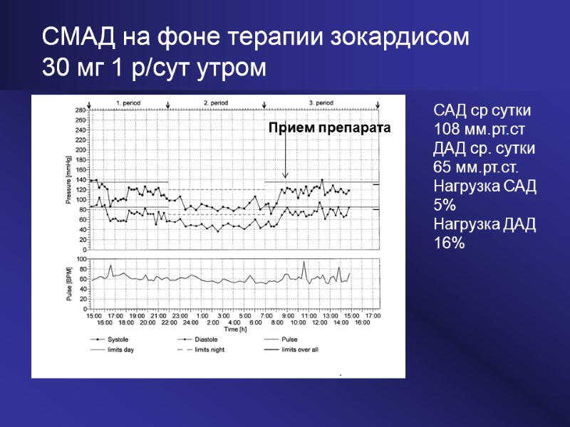 СМАД на фоне терапии зокардисом  30 мг 1 р/сут утром Прием препарата САД